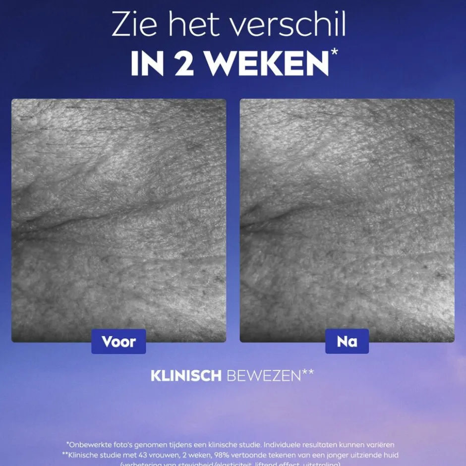 Nivea Skincare NIVEA Cellular Epigenetics Ultiem Huidverjongend Serum